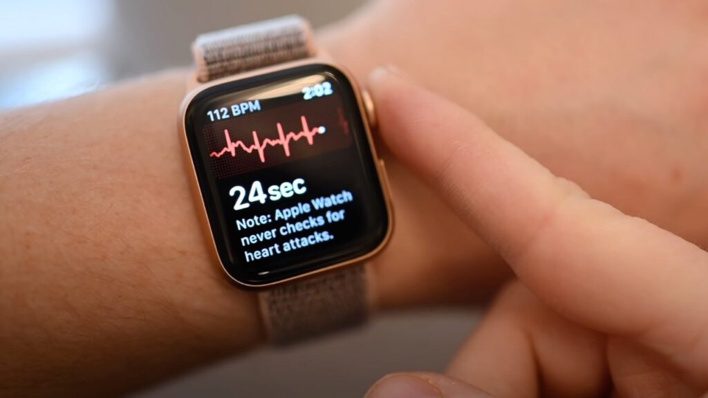 New study used Apple Watch to detect weak heart pump in patients